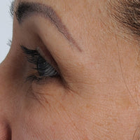 Woman before using NIRA for Hooded Eyes Treatment