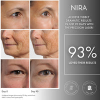 Real user 90 day results after using the NIRA Precision Laser