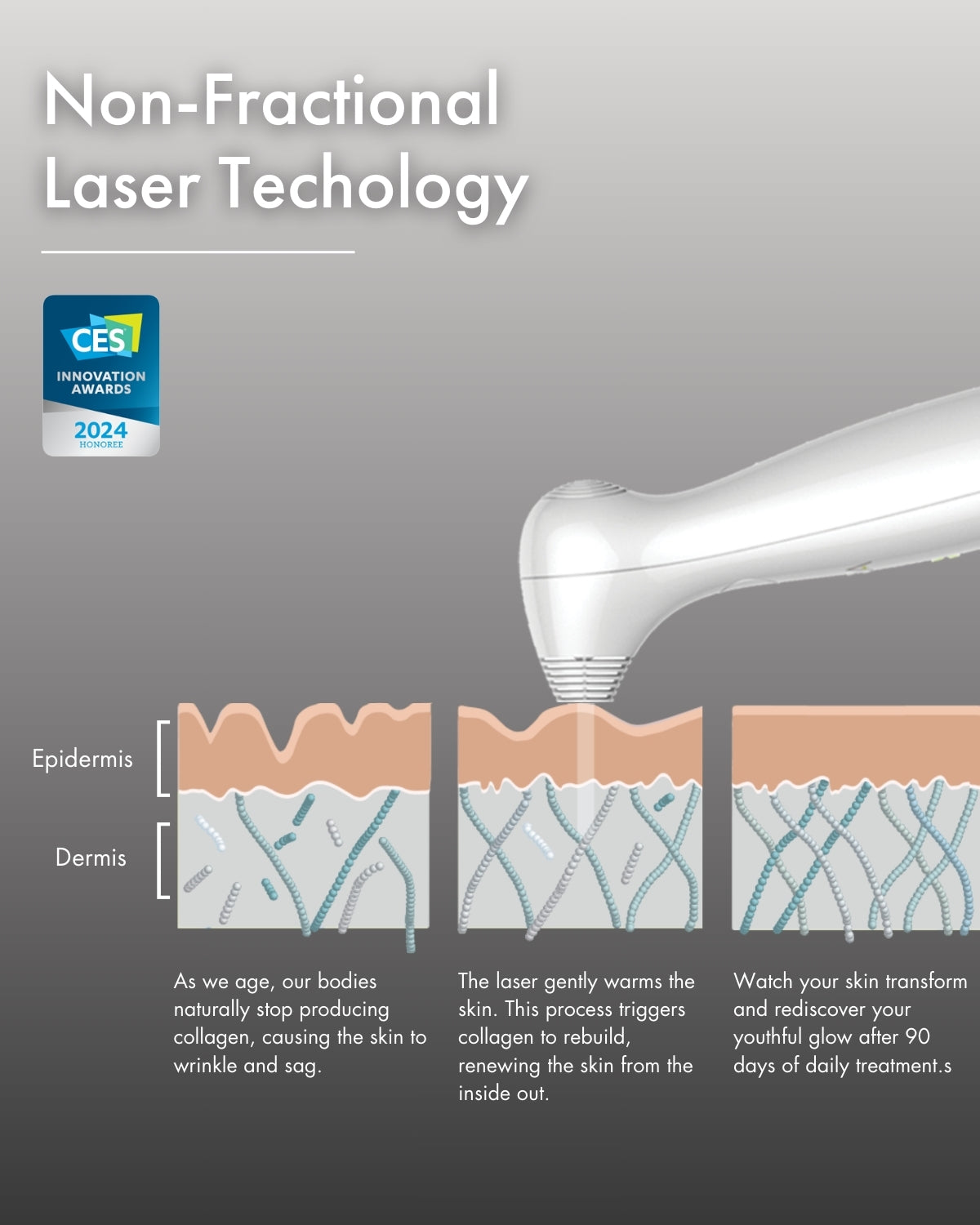 NIRA ProLaser