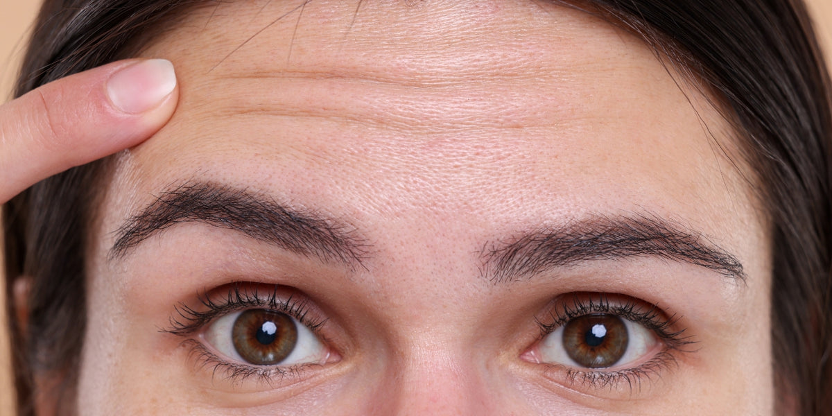 Woman raising eyebrows to reveal forehead lines
